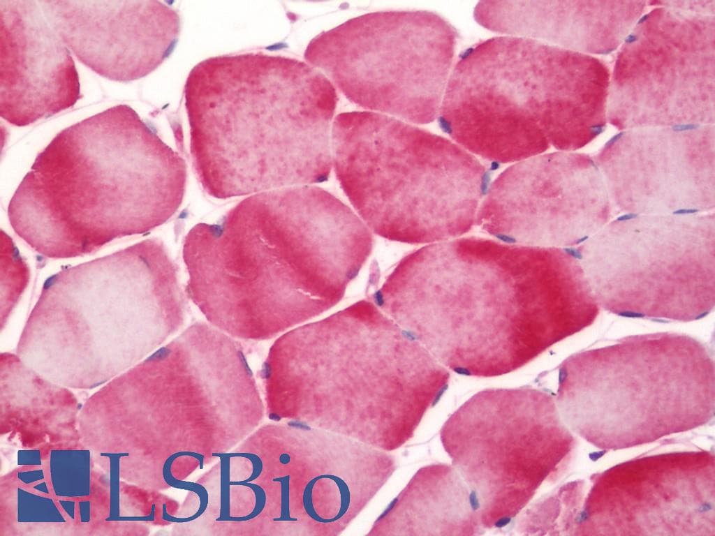 IHC-plus™ ITGA7 / Integrin Alpha 7 Antibody (clone 8G2)