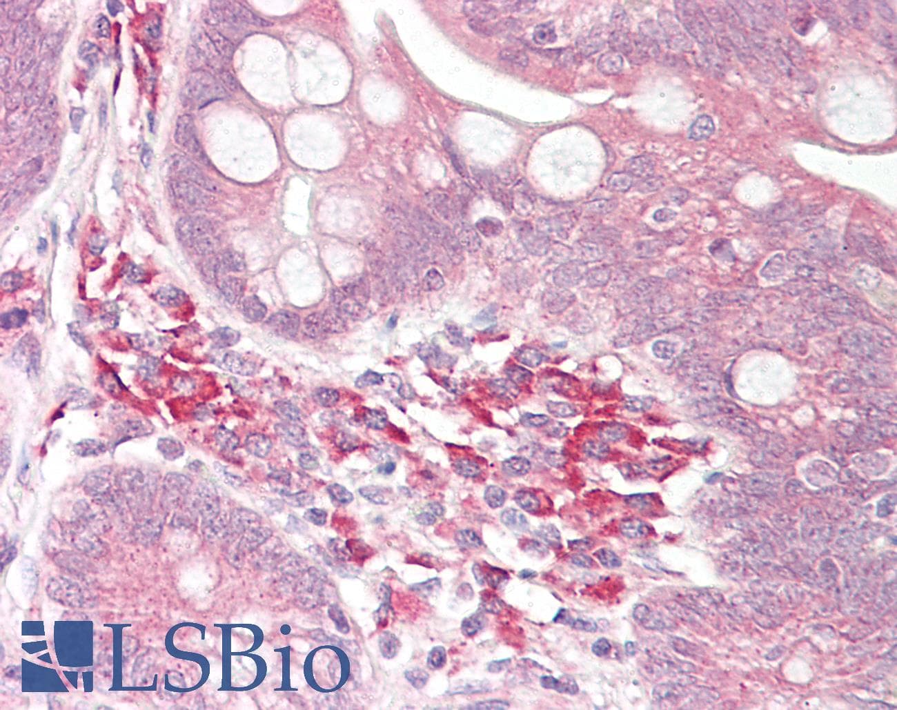 IHC-plus™ USP7 / HAUSP Antibody (aa1050-1100)