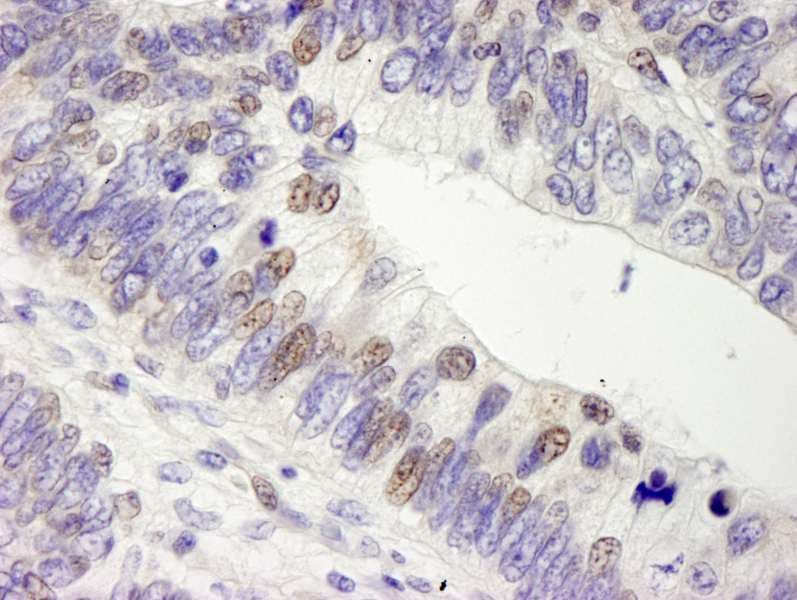 USP28 Antibody (aa50-100)