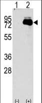 SNARK / NUAK2 Antibody (aa67-96)