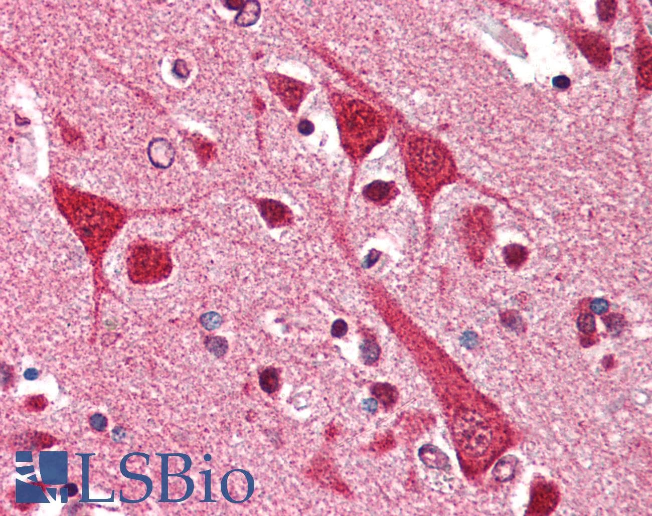 IHC-plus™ MAP1B Antibody