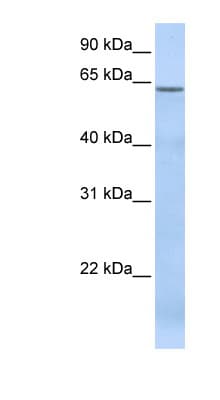 TBC1D22A Antibody (aa108-157)