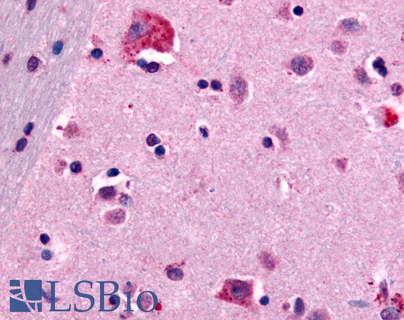 IHC-plus™ CNR1 / CB1 Antibody (N-Terminus)