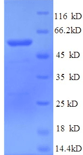 Human MUSK Protein (Recombinant 6His, N-terminus)