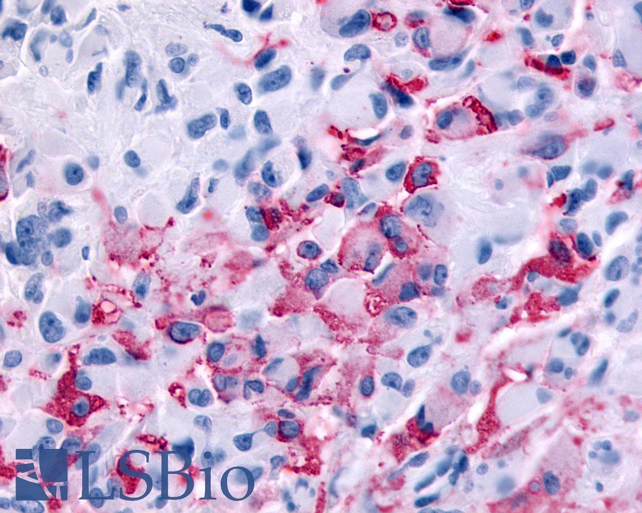 PathPlus™ Polyclonal Rabbit anti-Human RXFP2 / LGR8 Antibody (Extracellular Domain, IHC)