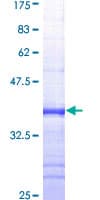 Human ABCB1 / MDR1 / P Glycoprotein (Recombinant GST, N-terminus)