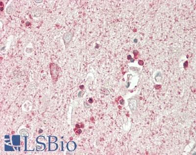 IHC-plus™ Polyclonal Rabbit anti-Human SEPT7 / Septin 7 Antibody (aa319-368, IHC, WB)
