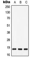 Polyclonal Rabbit anti-Human MAX Antibody (phospho-Ser11, WB)