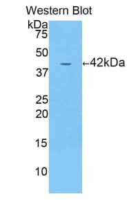 CRH / CRF Antibody (aa28-160)