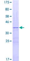 Human XDH / Xanthine Oxidase Protein (Recombinant GST, N-terminus)