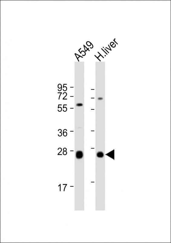 Polyclonal Rabbit anti-Human TRH Antibody (aa157-191, WB)