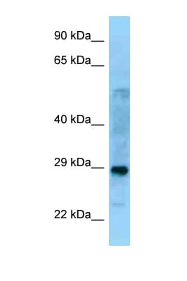 Polyclonal Rabbit anti-Human PROSC Antibody (C-Terminus, WB)