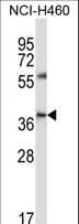 Polyclonal Rabbit anti-Human CD33 Antibody (aa88-117, WB)