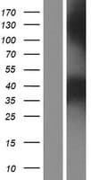 PPT2 Protein (Over-Expression Lysate Myc-DDK (Flag))