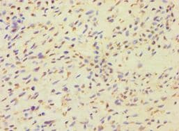 Polyclonal Rabbit anti-Human MCMBP / C10orf119 Antibody (aa1-240, IHC)