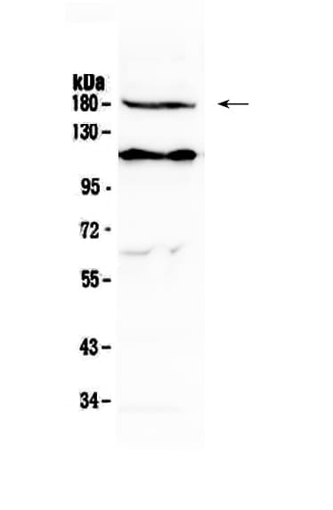 KDR / VEGFR2 / FLK1 Antibody