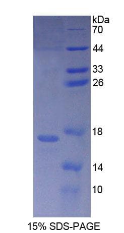 Human LGTN / EIF2D Protein (Recombinant His-T7)