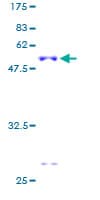 Human RPS9 / Ribosomal Protein S9 (Recombinant GST)
