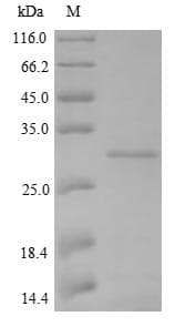 Klebsiella KPC, KPC-2 Protein (Recombinant 6His, N-terminus)