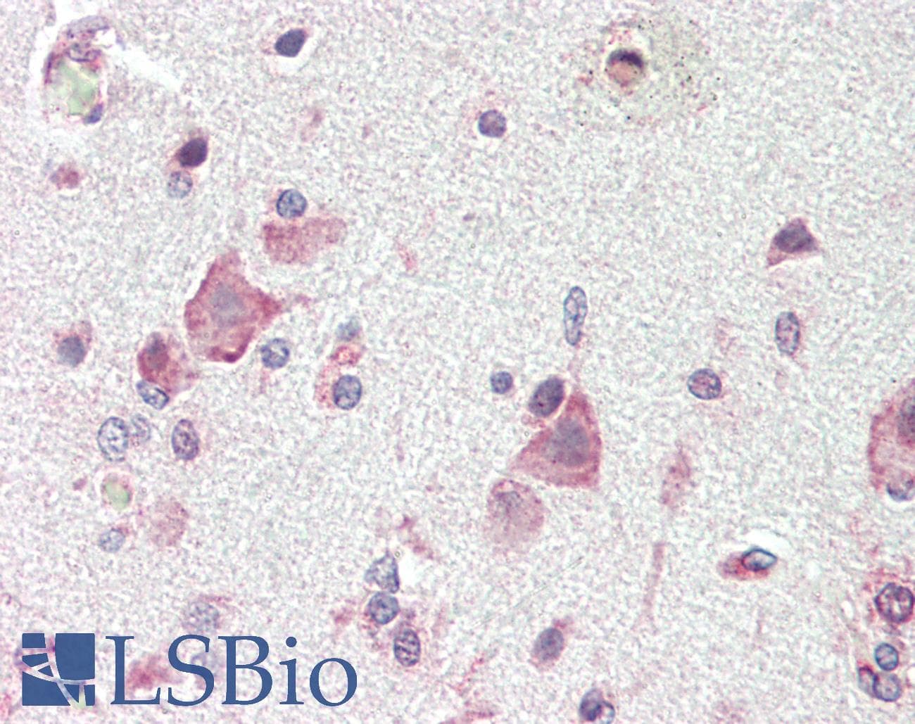 IHC-plus™ ADAP / FYB Antibody (C-Terminus)