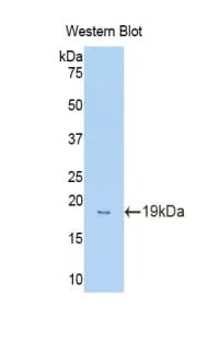 Glucocorticoid Receptor Alpha Antibody (aa622-755, Biotin)