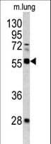 Polyclonal Rabbit anti-Human FLI1 Antibody (aa299-328, IF, WB)