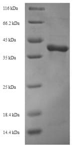 Nuclear Polyhedrosis Virus VCATH Protein (Recombinant 6His-SUMO, N-terminus)