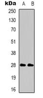 Polyclonal Rabbit anti-Human CD58 Antibody (Internal, WB)