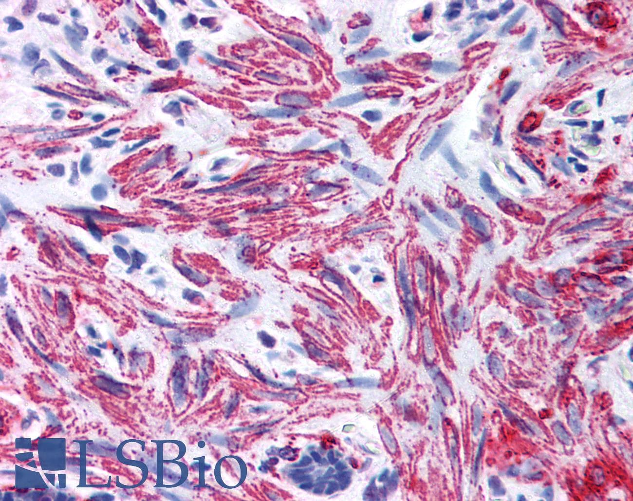 IHC-plus™ Polyclonal Rabbit anti-Human MLC2 / MYL9 Antibody (IHC, WB)