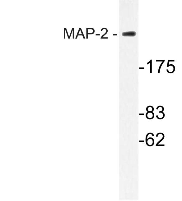 Polyclonal Rabbit anti-Human MAP2 Antibody (Trp14, IHC, WB)
