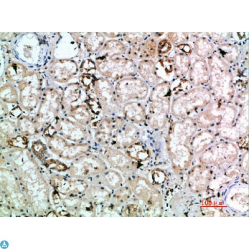 Polyclonal Rabbit anti-Human KLRK1 / CD314 / NKG2D Antibody (IHC)