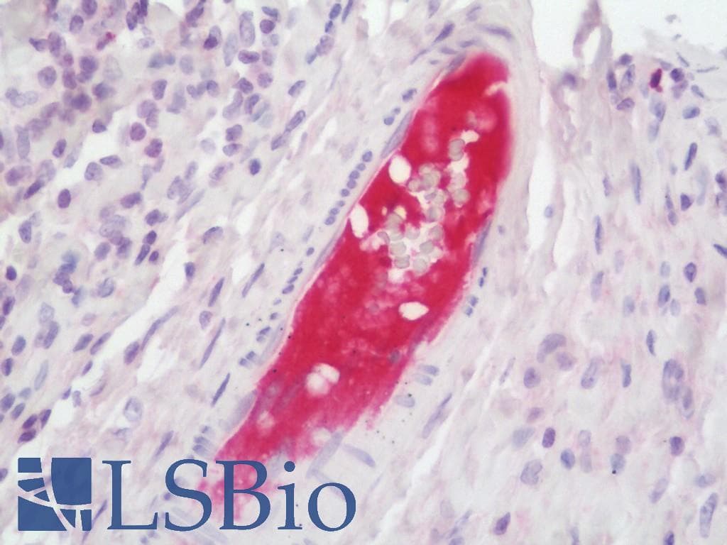 IHC-plus™ PLG / Plasmin / Plasminogen Antibody