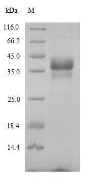Mouse ANTXR1 / TEM8 Protein (Recombinant 6His, N-terminus)