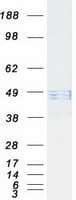 Human HYAL1 Protein (Recombinant Myc-DDK (Flag))