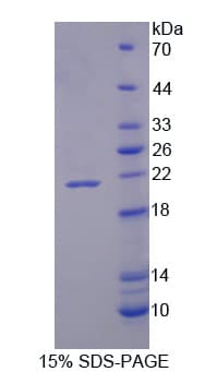 Mouse CD74 / CLIP Protein (Recombinant His)