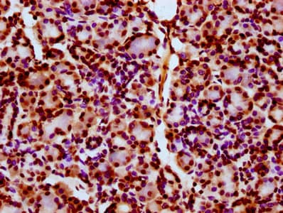 HIST1H2BN Antibody