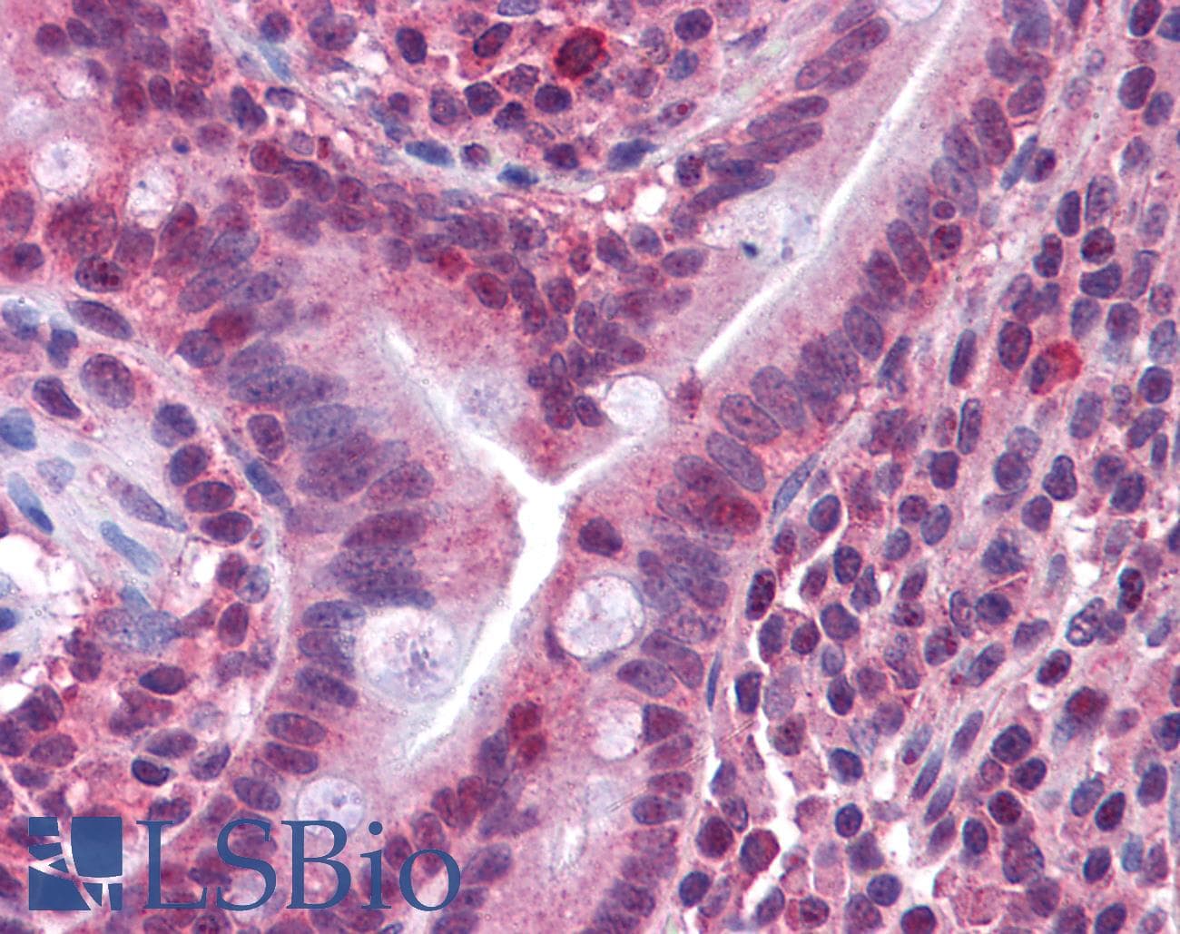 IHC-plus™ CACNG5 Antibody