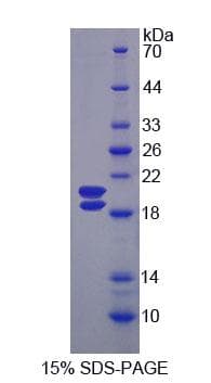 Rat UMOD / Uromodulin Protein (Recombinant His-T7)