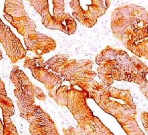 Monoclonal Mouse anti-Human Pan Cytokeratin Antibody (clone C11, Azide-free,BSA-free, IHC, IF, WB)