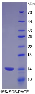 Rat CD66a / CEACAM1 Protein (Recombinant His)