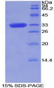 Rat TOR2A Protein (Recombinant His-T7)