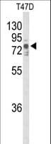 TNK1 Antibody