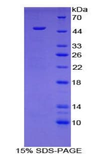 Mouse HYAL1 Protein (Recombinant His)
