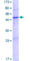 Human PTCHD1 Protein (Recombinant GST)