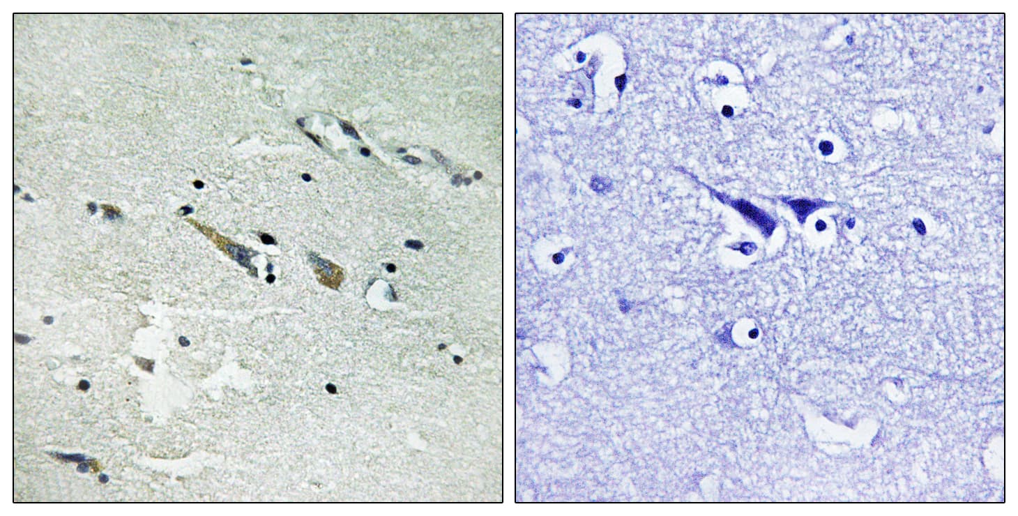 RAF1 / RAF Antibody (aa251-300)