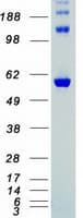 Human CHEK2 / CHK2 Protein (Recombinant Myc-DDK (Flag))