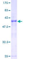 Human SSX2 Protein (Recombinant GST)