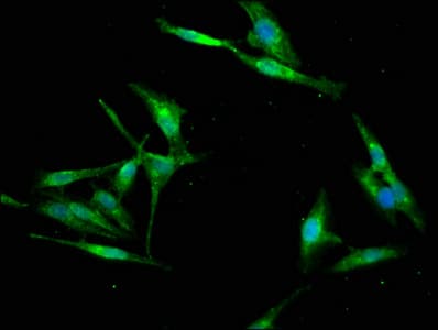 RBFOX2 / RBM9 Antibody