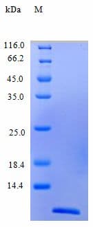 Human CCL4 / MIP-1 Beta Protein (Recombinant)