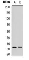 FOXE3 Antibody (Internal)